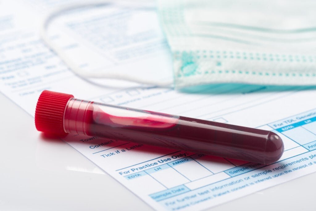 At Home Blood Test Accuracy: What to Expect